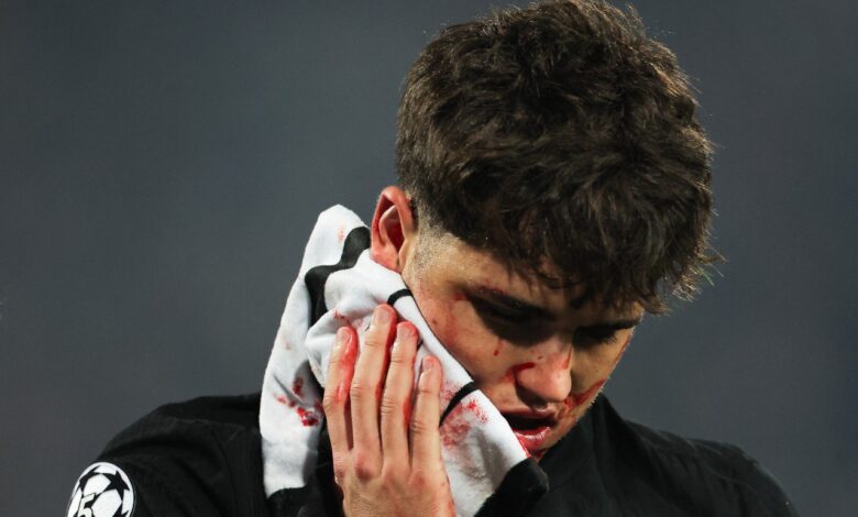 إصابة باو كوبارسي - برشلونة - المصدر: Gettyimages